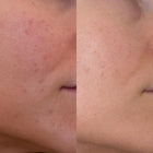 Skin Restrore