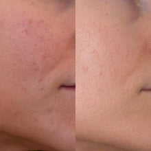 Skin Restrore