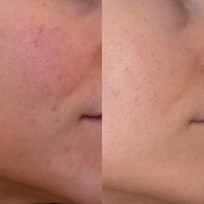 Skin Restrore
