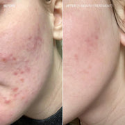 Jafnvægi og ljómi - Hormónauppbót