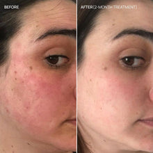 French Glow - Compléments alimentaires pour les rougeurs et la sensibilité