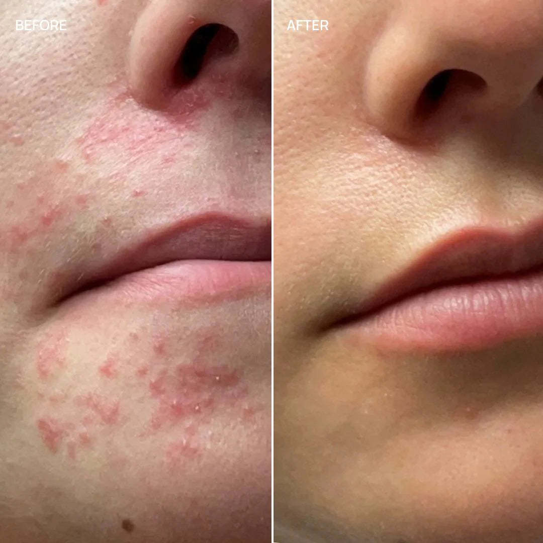 French Glow - Compléments alimentaires pour les rougeurs et la sensibilité