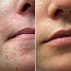 French Glow - Compléments alimentaires pour les rougeurs et la sensibilité