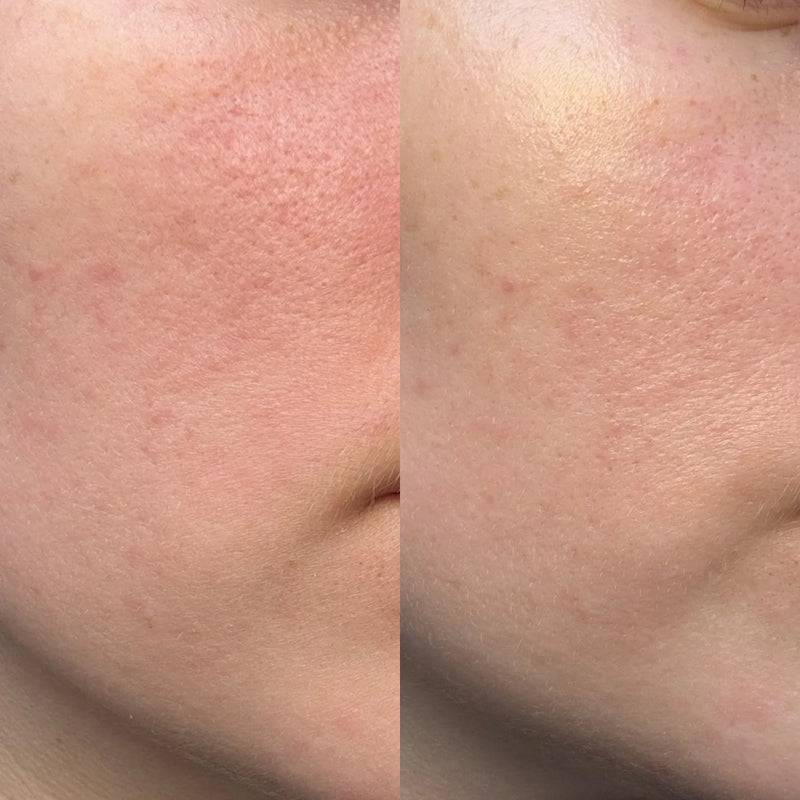 Skin Restore+